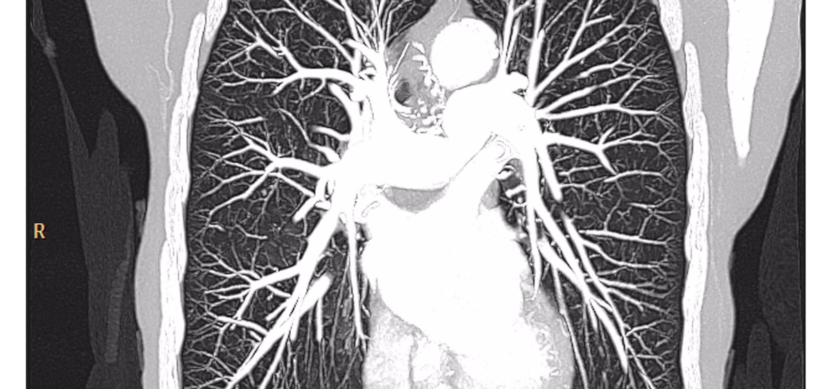 Doc_health's tweet photo. #iDose from @philipsindia provides low energy, low dose, and low injected contrast imaging.
https://t.co/pgE1pV15qZ Find more at #IRIA17 https://t.co/ly7OKTRz6C