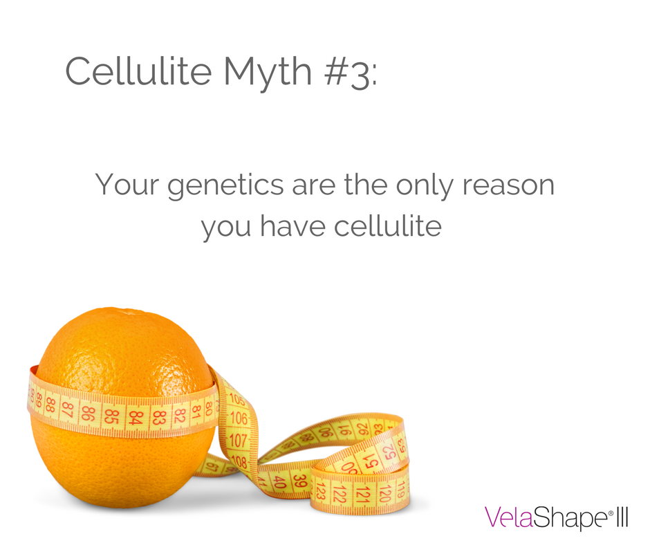 Hormones, stress, poor eating habits, lack of exercise &amp; your weight can all contribute to cellulite #cellulitemyths