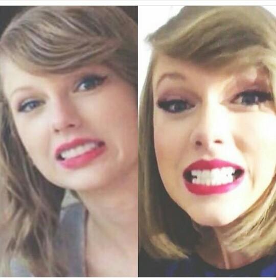 Taylor Swift Teeth Before And After