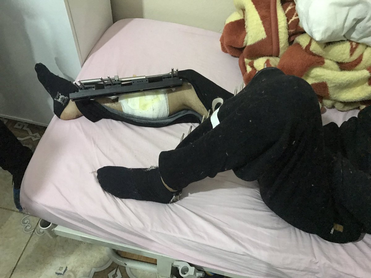 Abramjee's tweet photo. #SAveSyria #OperationSA #InsideSyria Tens of thousands of Syrians have been injured and paralyzed. It's distressing! @QariZiyaadPatel https://t.co/wZWbqytwZG