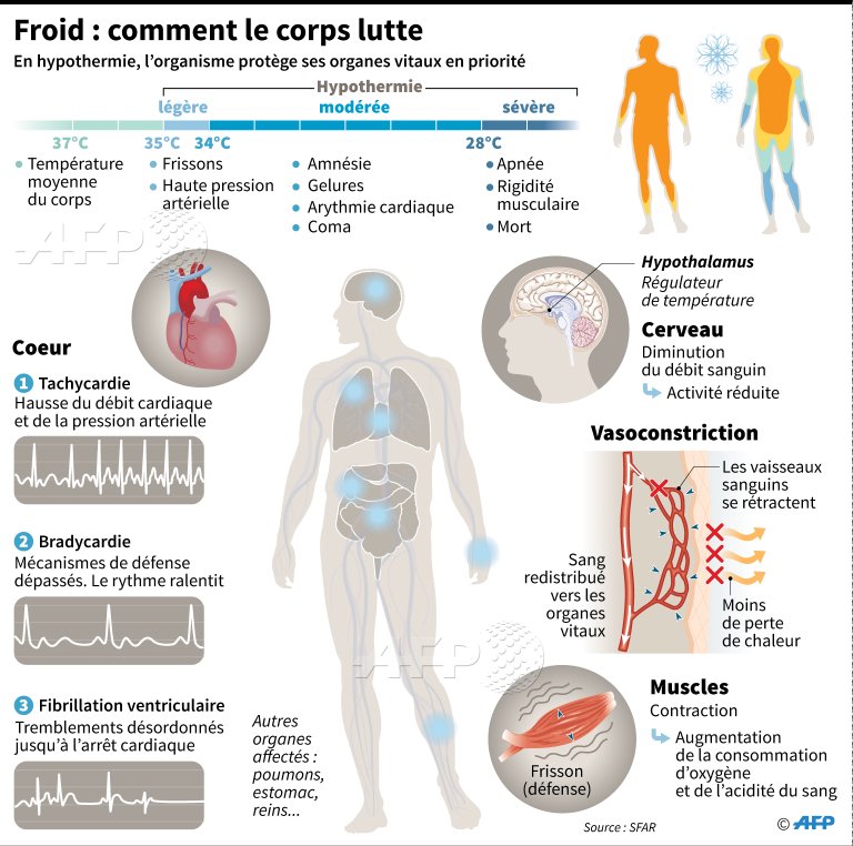Les effets du froid sur le corps #AFP par <a href="/AFPgraphics/">AFPgraphics</a>