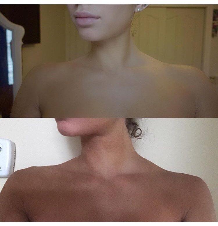 LaBoomByCrystal's tweet photo. #FridayTransformation to Before & After Using LaBoom!
Our LBA shared her amazing results,
Her skin looks absolutely smooth & flawless! https://t.co/wOqOvneGAg