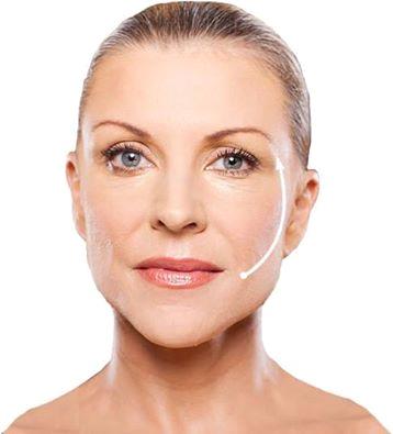 HBHealthLondon's tweet image. SAGGY SKIN NO MORE! #silhouettesoft #SkinRenewal #facialthreads #antiageing hbhealthofknightsbridge.co.uk/thread-lift/