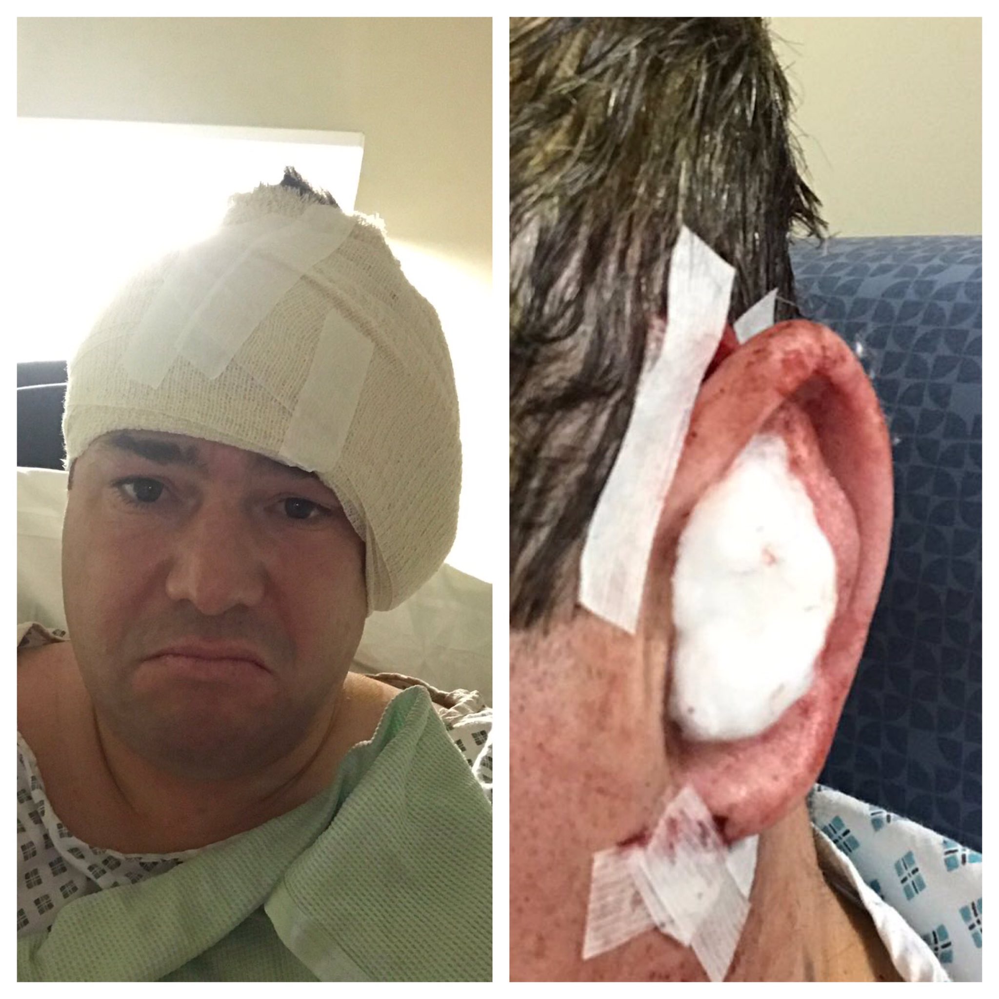 Vicky on X: "Well @carlrecine is home after his surgery and hopefully on  the mend! #braveboy #Mastoidectomy https://t.co/HgpOCtqaPc" / X