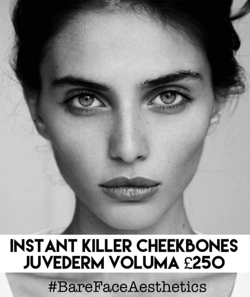 greglebrasseur's tweet photo. Cheek fillers are one of our best anti ageing treatments. #juvederm #voluma #CheekFillers #BareFaceAesthetics #KillerCheekbones #facelift https://t.co/H18Im0icYK