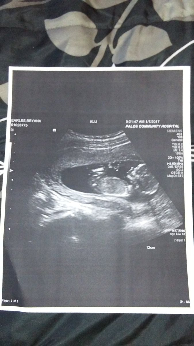 BreMurdaa3's tweet image. Baby Gone Be Here In 6 Months😍😘