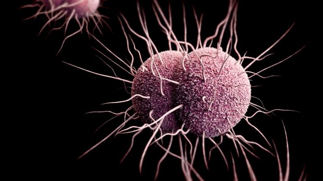 CDCSTD's tweet photo. #Clinicians: Untreated #gonorrhea can increase your patients' risk of getting, giving #HIV. https://t.co/GtXt8z2Pon https://t.co/PVPLjLd242