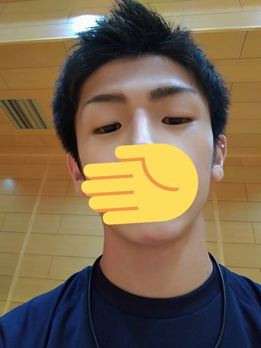 Moto 脱毛の人 On Twitter 体育館で滑り込んで顎ケガした 笑 若干赤いし 地味に痛いしだるいやつ 笑