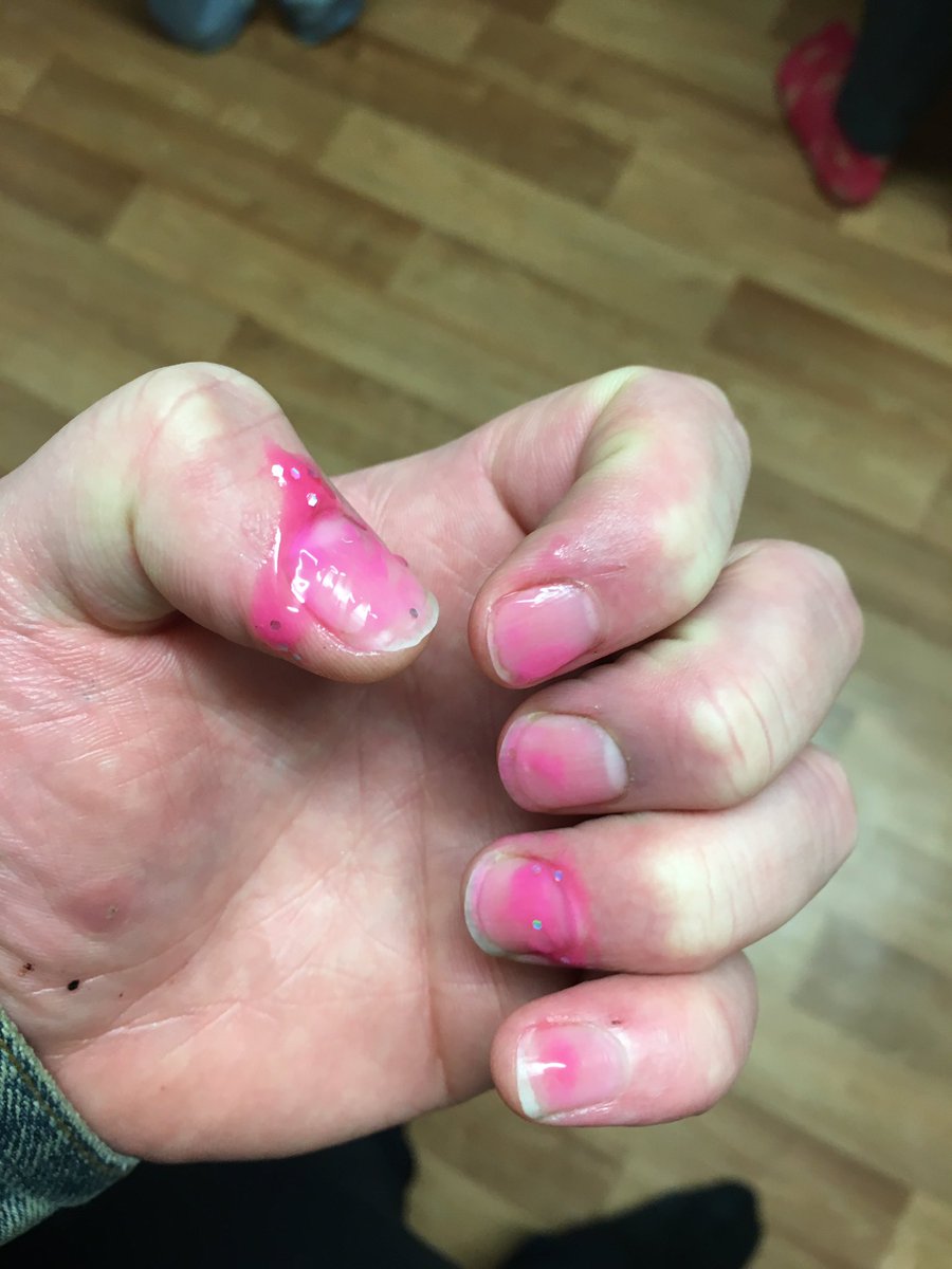 Didn't want a manicure full stop so lord knows why I let a two year old give me one 😔 #princess not feeling #pretty <a href="/liambeever/">Liam Beever</a>