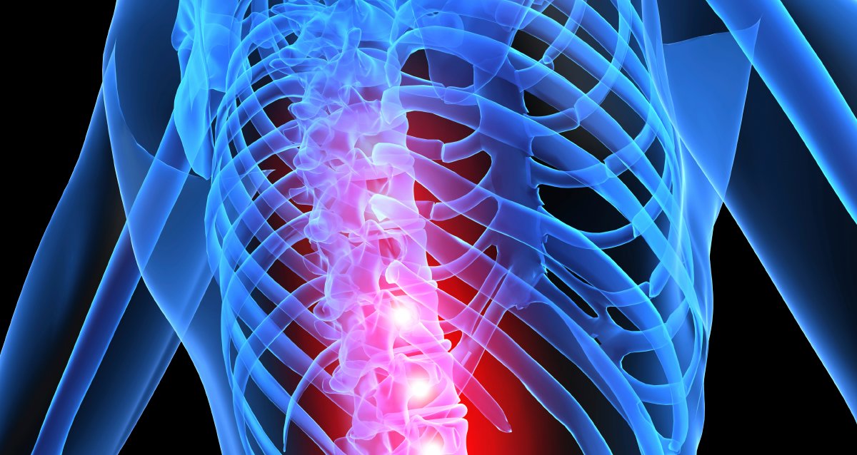 One study shows up to 42% of people w/ chronic lower back pain experienced depression before the back pain started. wb.md/2juJ2vU