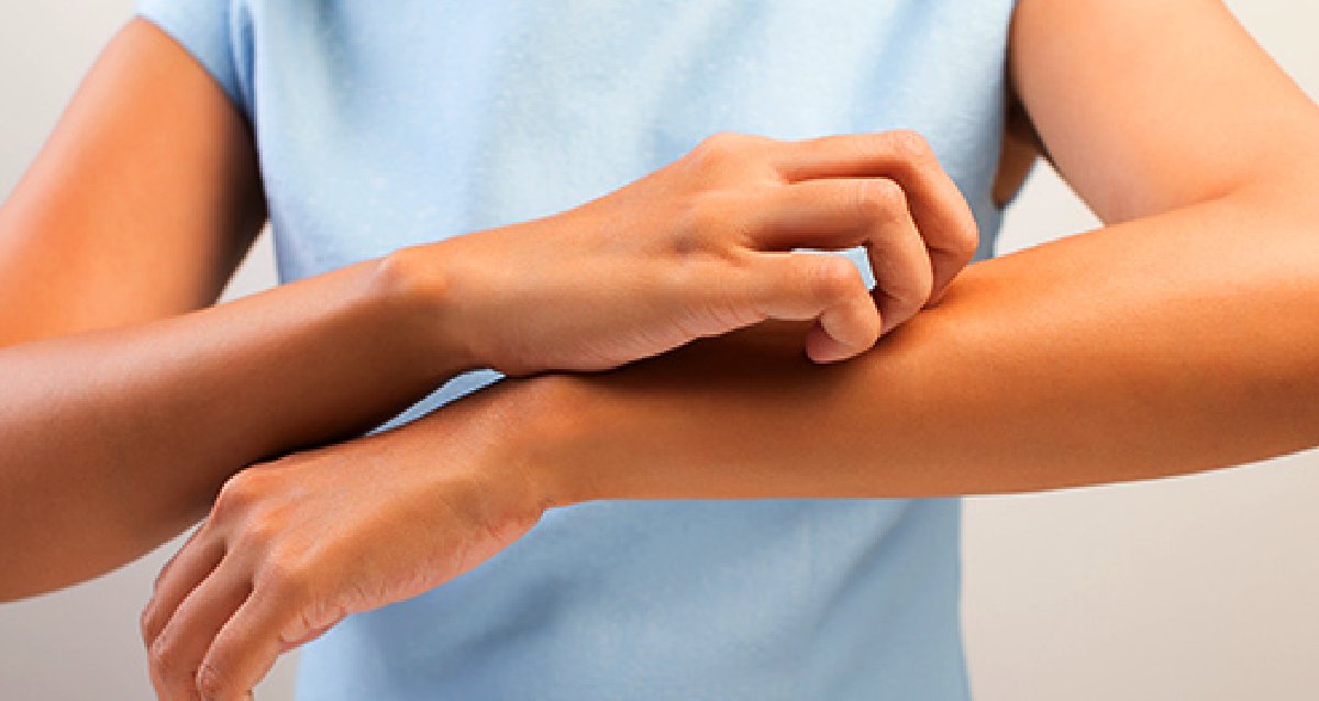 Many things can cause dry skin, and what you can do it about it depends on what brought it on. wb.md/2iV3ToR