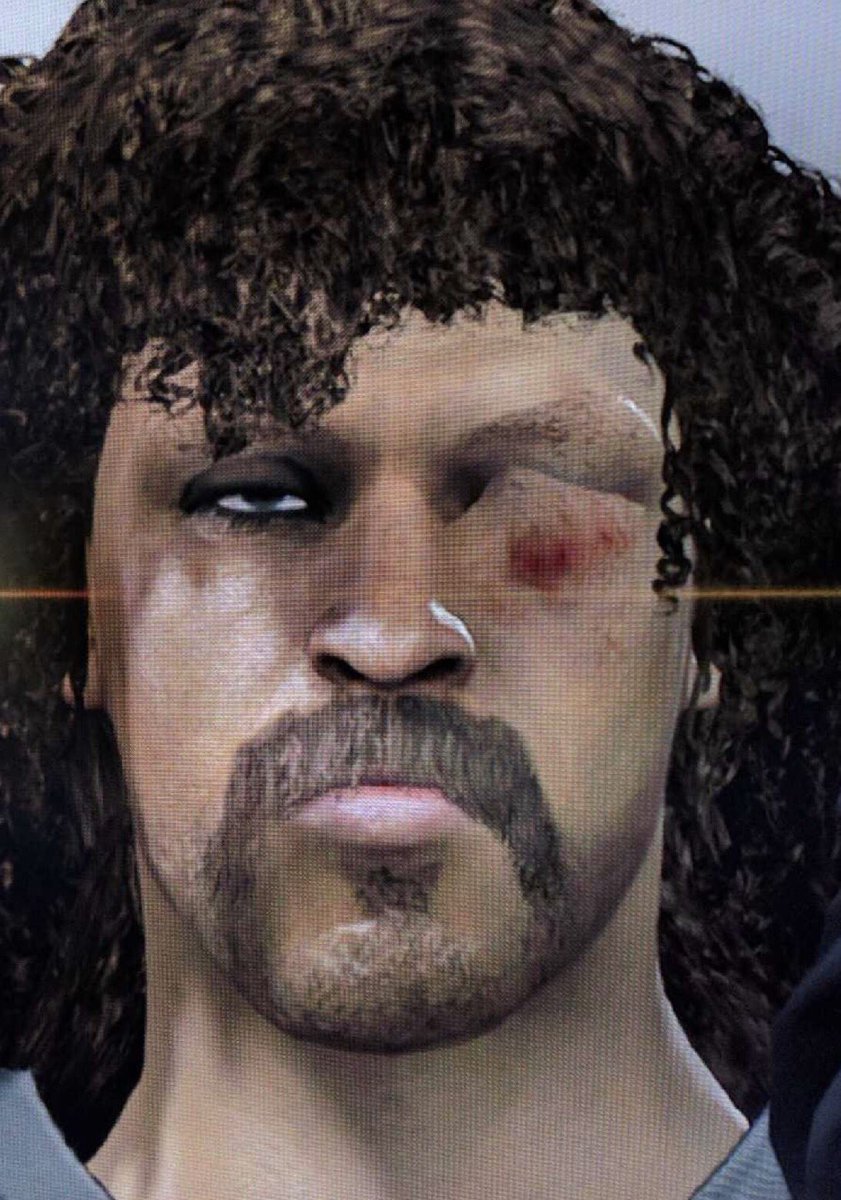 Kinks2Curls's tweet image. Rumors of this pic of @TitoBSanchez4 r false. Our product doesnt drip in2 eyes &amp;amp; cause swelling. We r rethinking Tito as face of Kinx2Curlz.