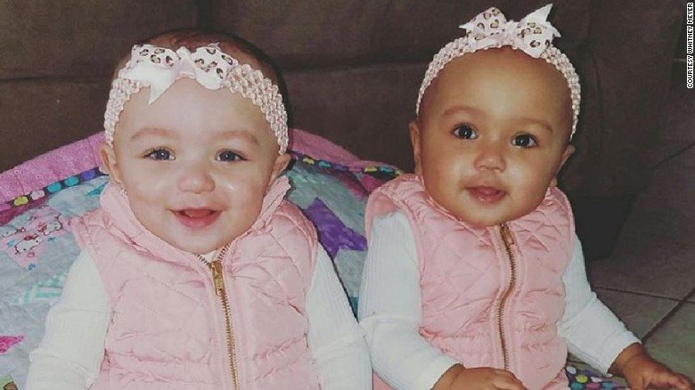 CNN's tweet image. It's a biological rarity: These twin baby girls have different skin colors cnn.it/2kgki7J
