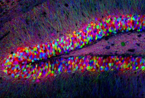 CNRS's tweet photo. L'image de la semaine: "Les 100 couleurs du Brainbow", à découvrir dans le #BlogNeurosciences de #CNRSleJournal https://t.co/DApifirA2j https://t.co/BbVtIqM5fW