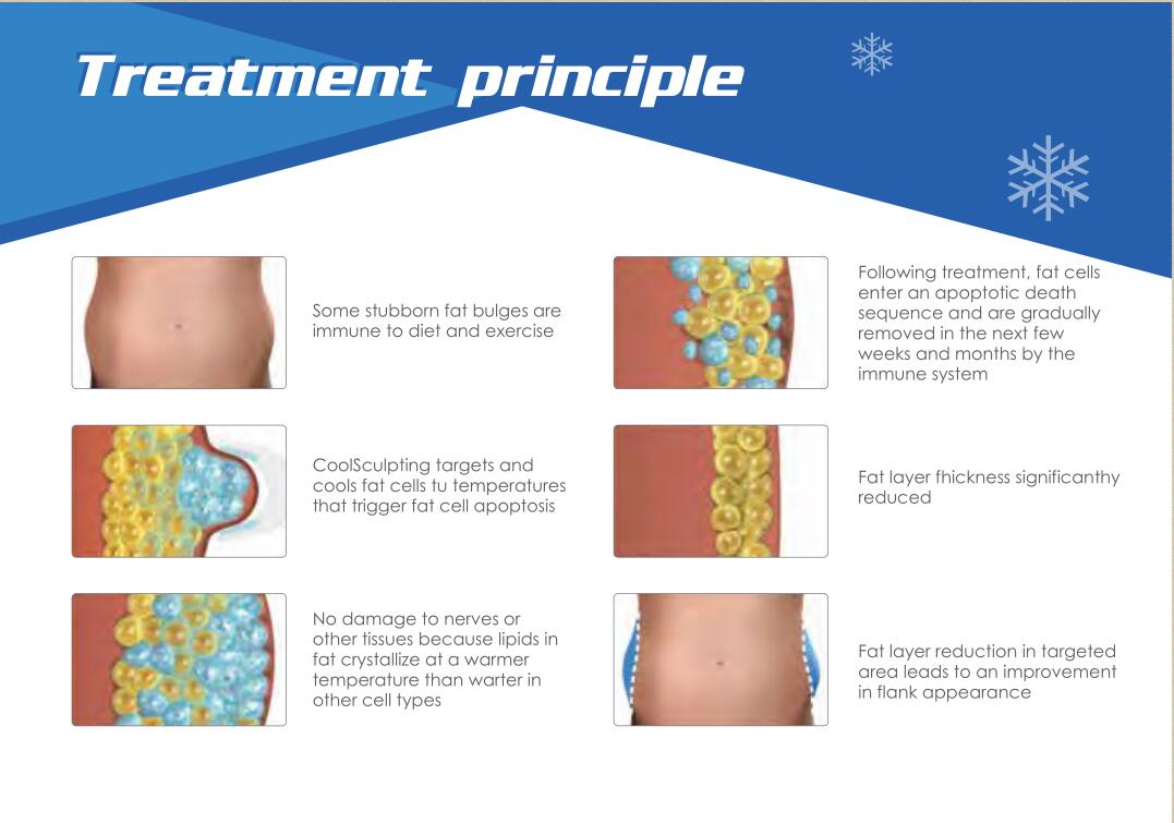 LBeautyMachine's tweet image. Nubway newest Cryolipolysis Machine! Totally 4 cryo handles!
Very effective for stubborn fat removal!
Lydia@nubwaycompany.com
+8618712785196