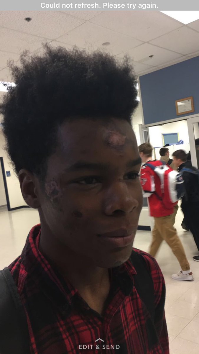 Collin was beat by liberal protesters in Washington, D.C. On Friday afternoon. He ultimately caught an assult charge for fighting back...