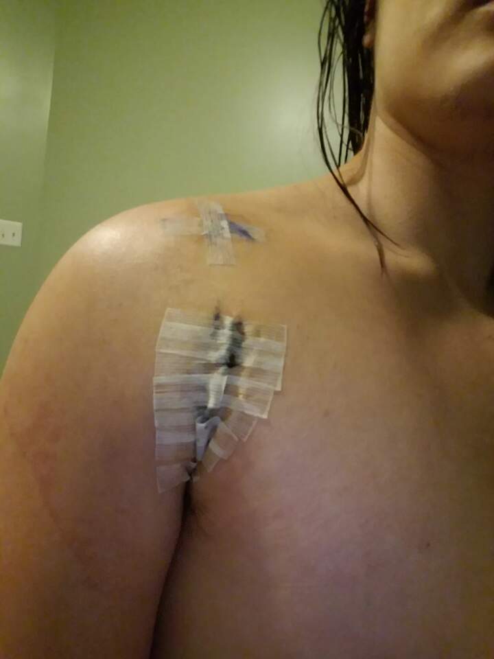 This shit fucking ITCHES