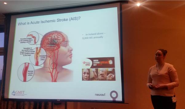 NeuraviLtd's tweet photo. Congrats @sharon_duffy92 on #bini2017 presentation on histopathology of thrombi that cause stroke.  @NeuraviLtd https://t.co/qWkH3zRc9L