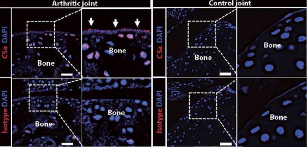 Immunopole's tweet image. #C5aR initiates #neutrophiladhesion required for immune complex-induced #arthritis @sciencemagazine lc.cx/JcWo