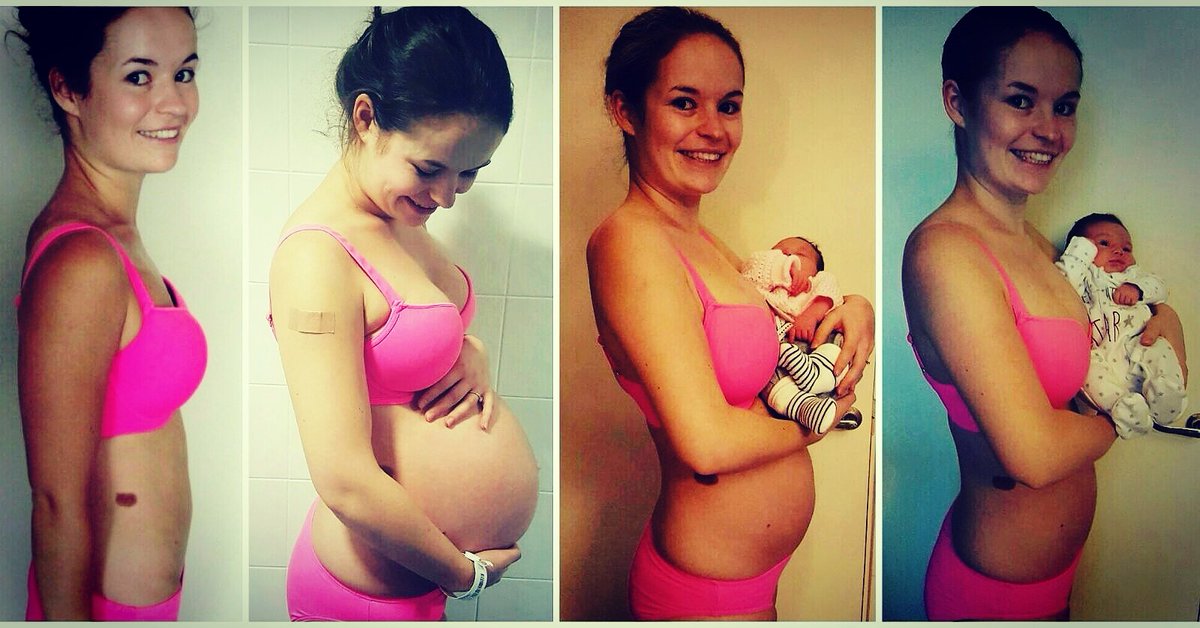 PT_Hackney's tweet photo. 3 weeks after giving birth and already back to the weight before she was pregnant.
#baby #results #fitness #Diet #pregnancy #beforeandafter https://t.co/giLjygjn0M