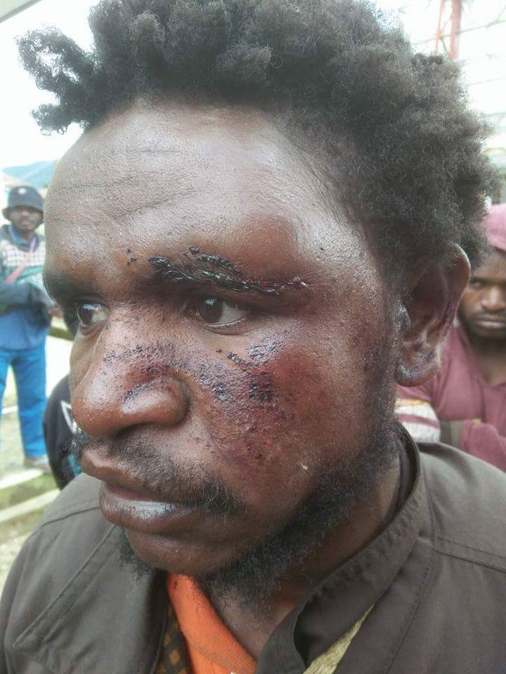 jumat kemarin (20/1), bbrp org di Dogiyai #Papua disiksa aparat pd saat sweeping.
 Arogansi aparat ini sempat diprotes warga minggu lalu.