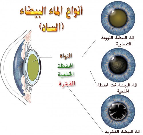 RoayaEC's tweet photo. أنواع الماء البيضاء
.
.
.
..
#بالشواهد_البنات_اذكي_من_العيال
#استغفرو_ربكم_ايها_الرفاق
#مسابقه_هايبوينت_للناجحين
#جنود_السعوديه_فخر_السعوديه https://t.co/T39vsWCvJQ