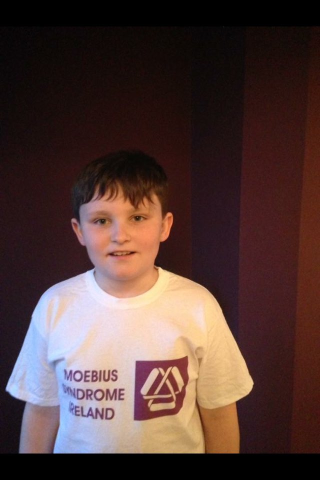 Moebiusireland's tweet photo. Supporting his big sister to help raise awareness for #msad2017 #moebiussyndrome #moebiuspurple #msad https://t.co/WPKaWcnirE