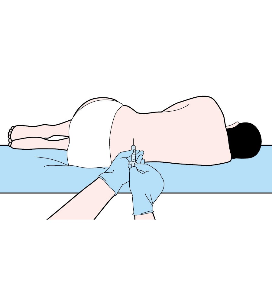 sinaiem.org/?p=11539&previ…

Try ultrasound for your next LP! <a href="/SAlerhand/">SAlerhand</a> <a href="/emdocsdotnet/">emDOCs Team</a>