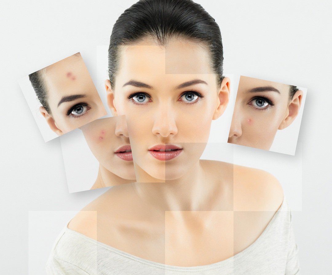 Nitevaya lift of face and body - what do we know about it Nitevaya lift of face and body - what do we know about it