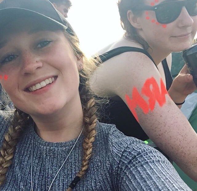 eleanorpc_'s tweet photo. Happy birthday you ugly fuck #armleg #lif https://t.co/WtN9ujwx0i