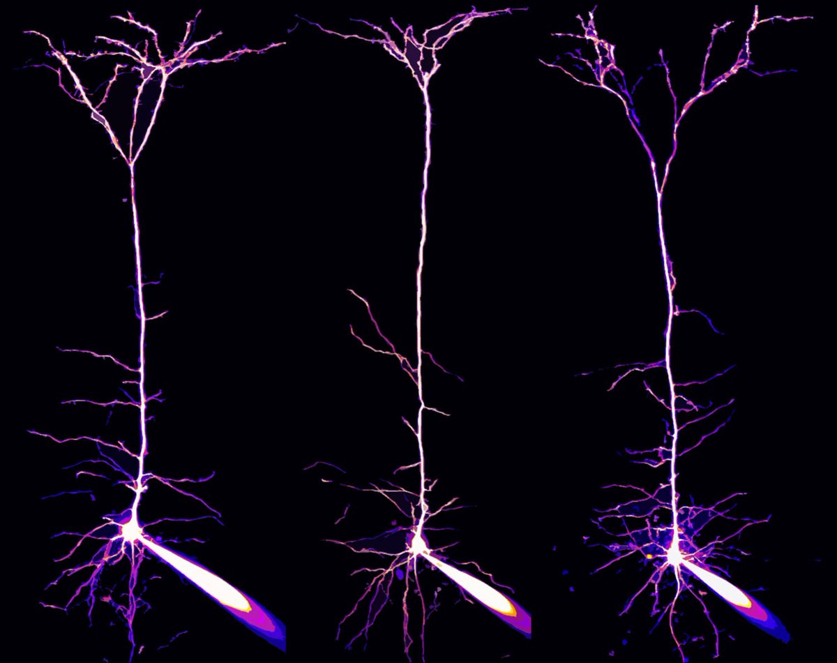 These are pyramidal neurons and their dendrites visualized in the visual cortex of a mouse #brain. Image by #AlexandreWIlliamMoreau #science