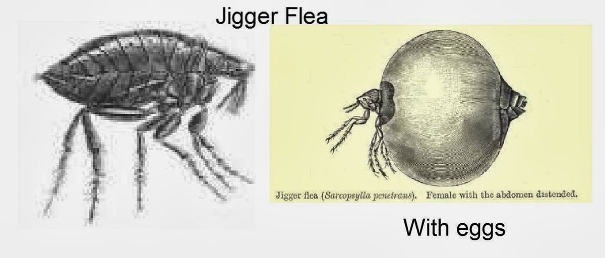 Jigger Parasite
