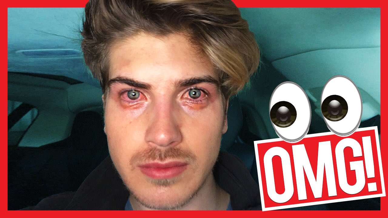 going blind