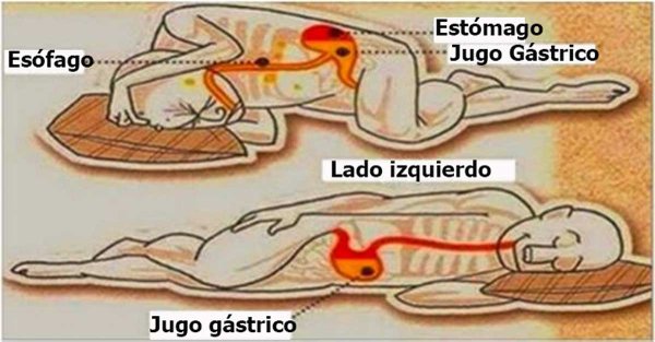 icolorojos's tweet photo. Esta es la razón por la cual debes dormir sobre tu lado izquierdo.
¡MUCHO CUIDADO! 😱😱😱
Ver video → https://t.co/pH4P8eLr4e https://t.co/BnNP6ExdqI