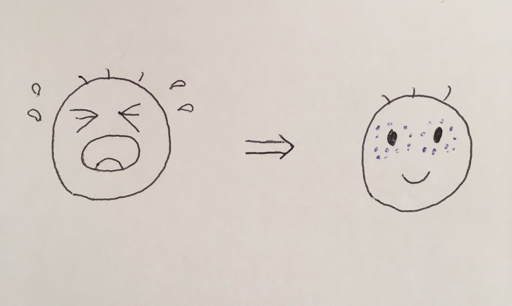 パパ小児科医 赤ちゃんがギャン泣きしますと 細い血管が切れて目の周りなどに点状出血が出ることがありますが これは正常でも起こるもので時間がたてば自然に消えます 程度がとてもひどかったり なかなか消えないときは検査などすることもあります