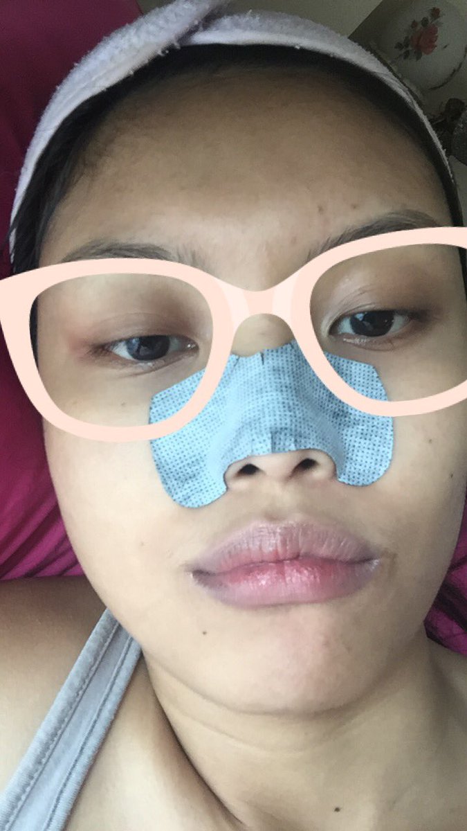 azeemaduli's tweet photo. Face day be like https://t.co/FAfYrSjWKX