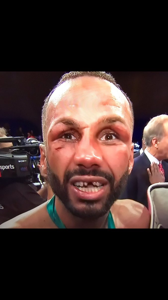 I won the fight though you guys !