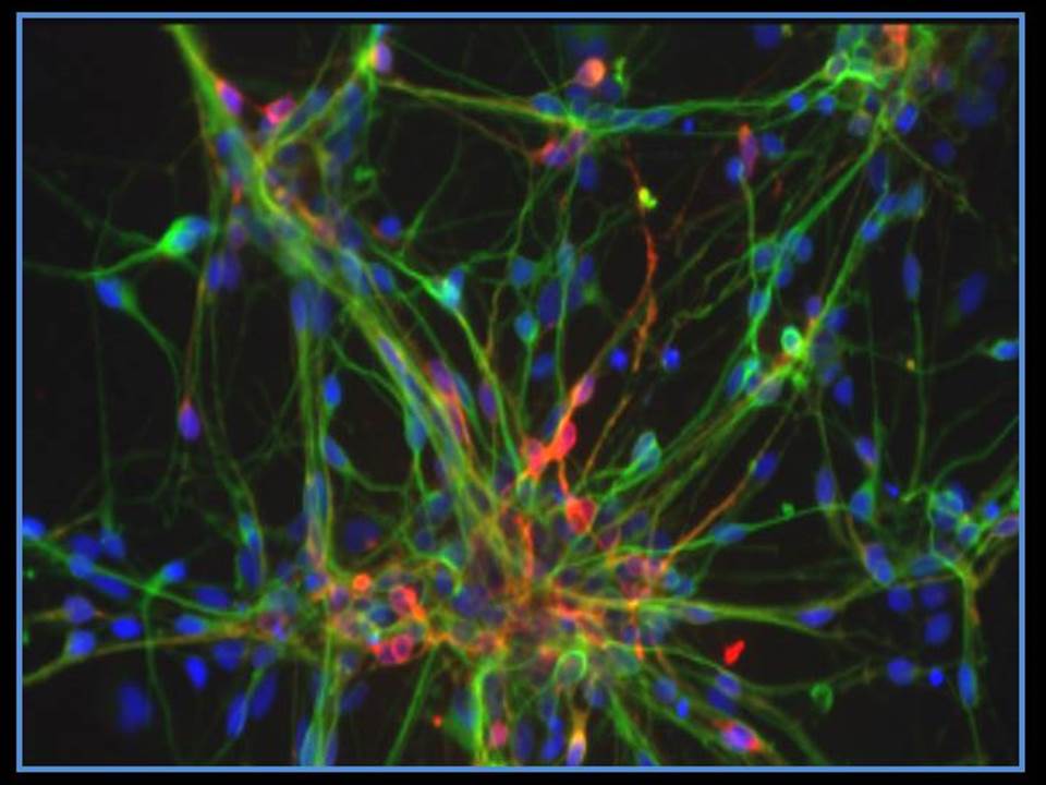 jan_nolta's tweet image. My #StemCellResolution is to continue to help our teams and collaborators work toward better therapies and cures for patients who need them.
