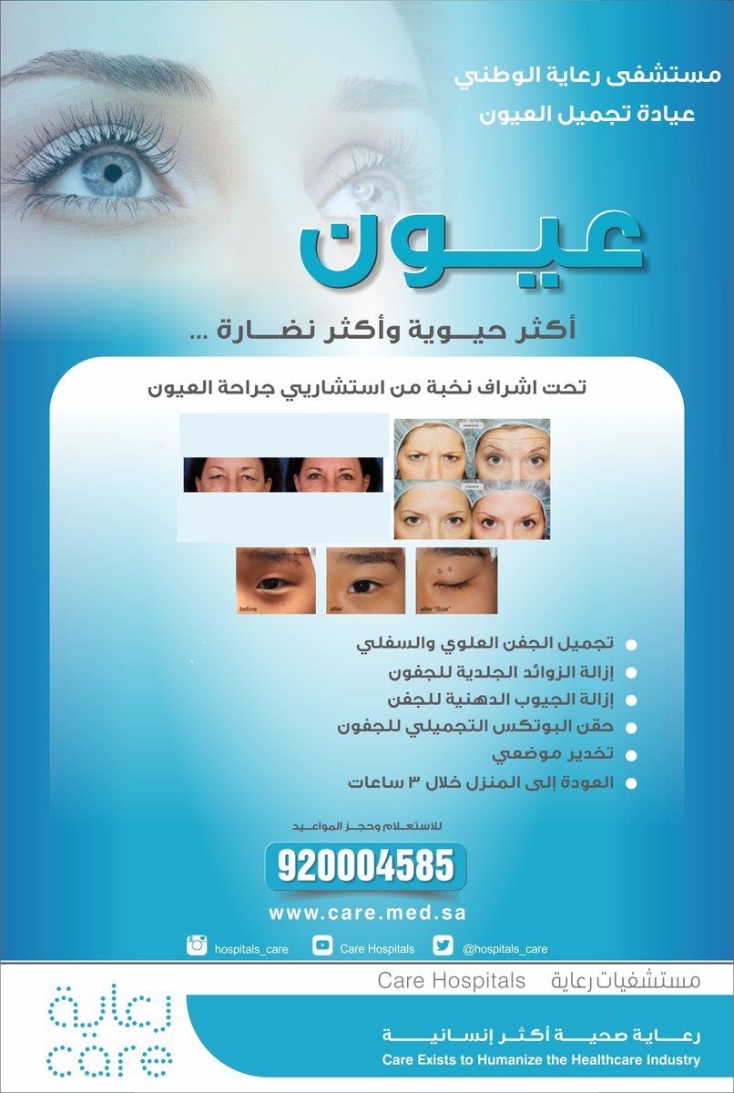 hospitals_care's tweet photo. عيون اكثرحيوية و اكثر نضارة 
#رعاية_صحية_أكثر_إنسانية  
#الرعاية_هدفنا
#طب #معلومات
#صحة #care https://t.co/fdkvdfoGXY