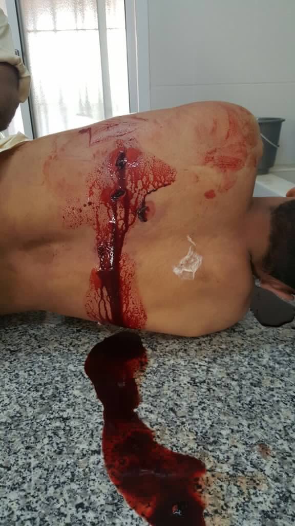 alawi_ghuraifi's tweet image. لا تغسلوا منهُ الدماءَ فإنّها
وردٌ.. وغضنُ عروقـهِ الأشذاءُ

وصمودُهُ اخترقَ الرصاصَةَ قائلاً..
"إنّ الشهـادةَ عِـزةٌّ ونمـاءُ"

#جرح_شعبي