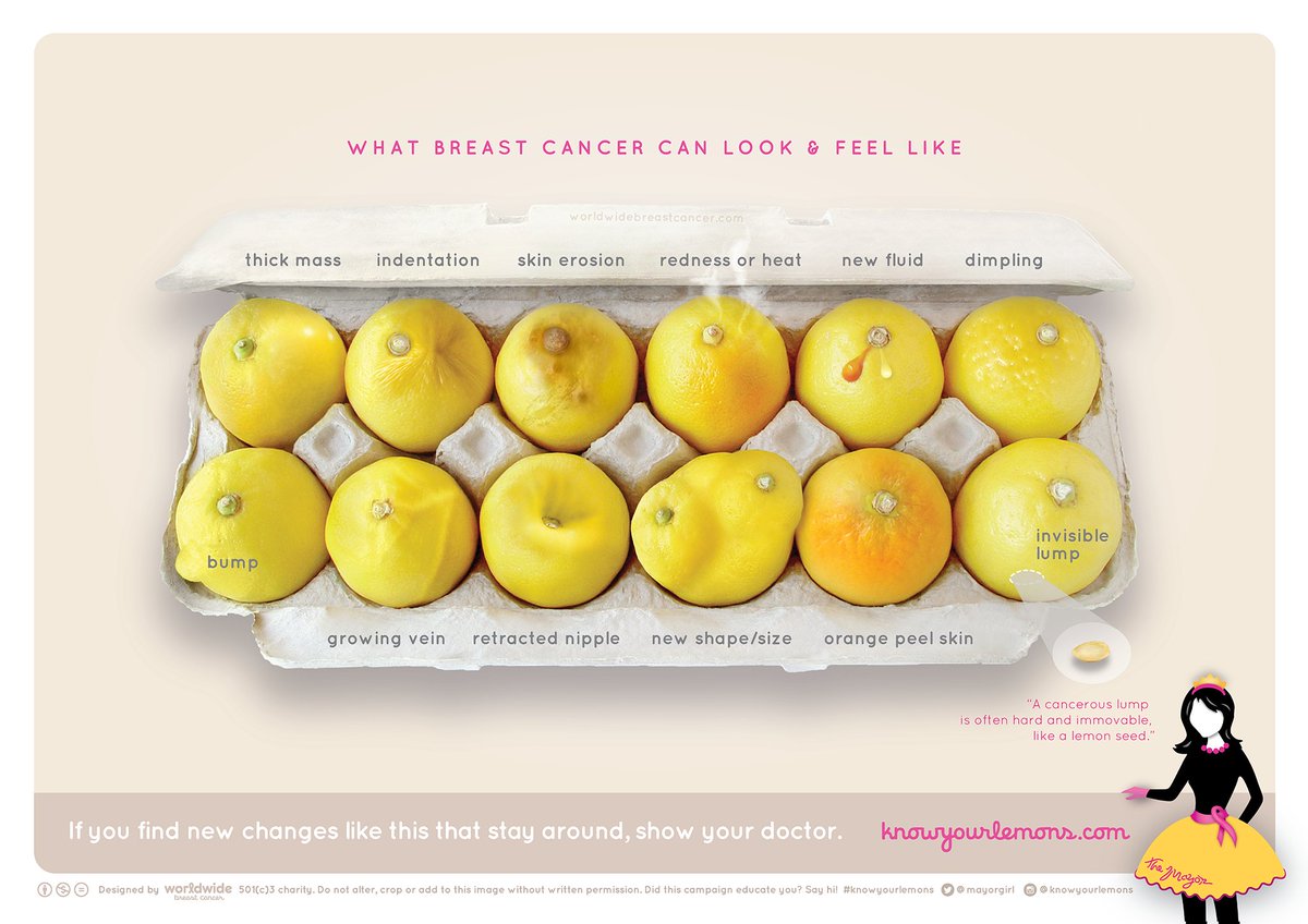 MrPKalu's tweet photo. What #BreastCancer can look like! #KnowYourLemons @MayorGirl https://t.co/BvMHsb5ASz https://t.co/kik0ebTm4X