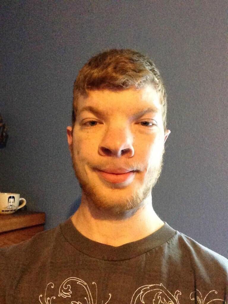 Far Apart Eyes Attractive