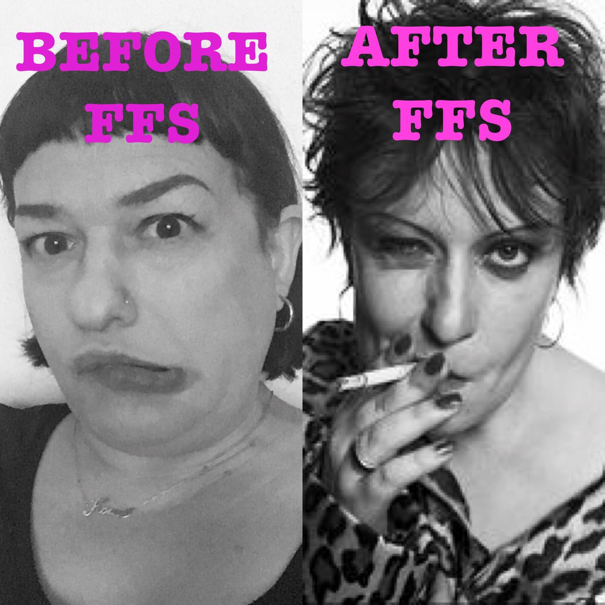 warminvention's tweet photo. https://t.co/HC2SixnnU2 #help #poverty #surgery #facialteam #ffs #rich #donate #loan #philanthropy #trans #MakeItHappen https://t.co/pfHB84z9Uz