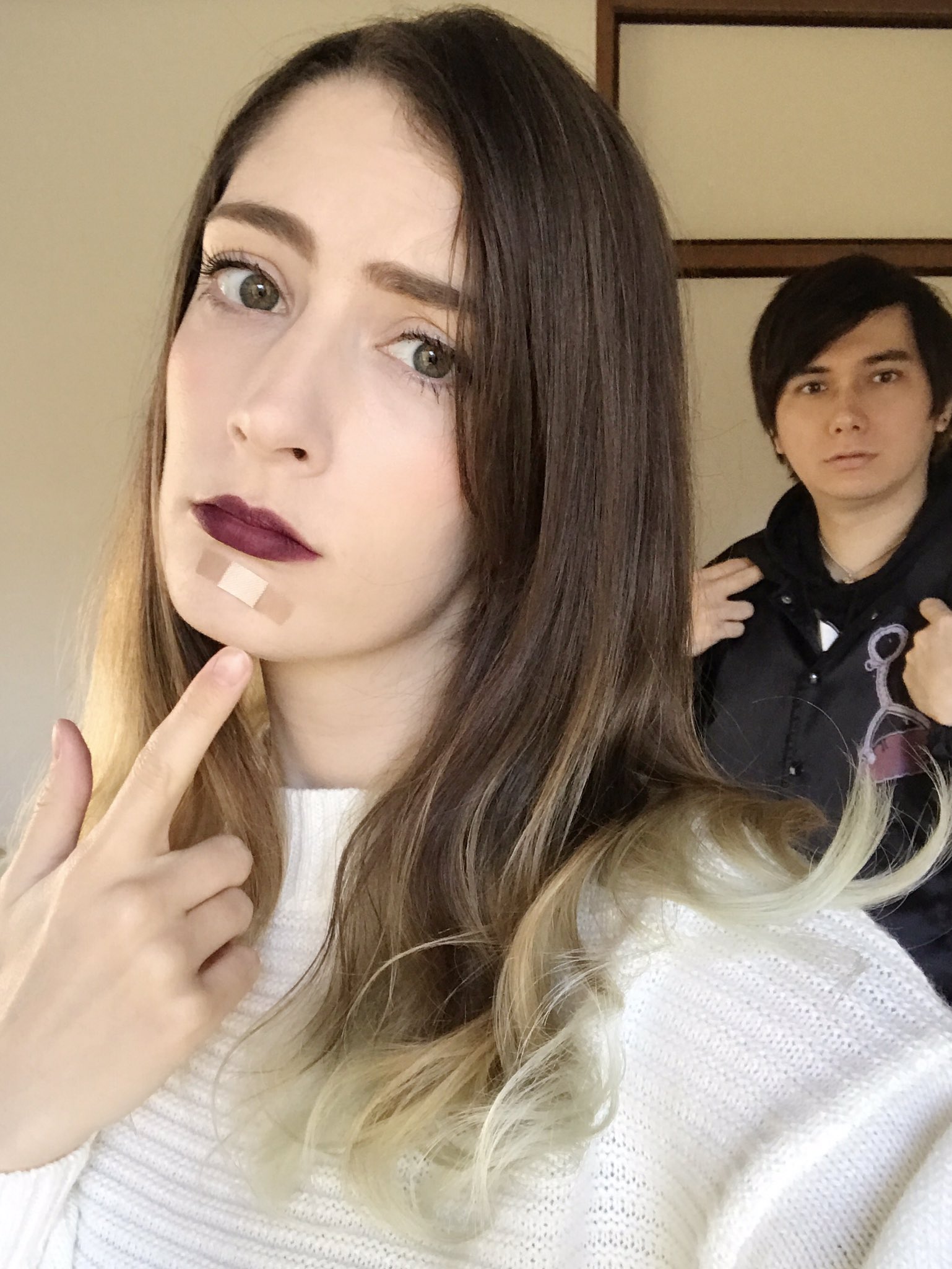 Mimei 絆創膏でニキビ隠してる 触らないようにね Got The Angriest Pimple Hiding Under The Plaster