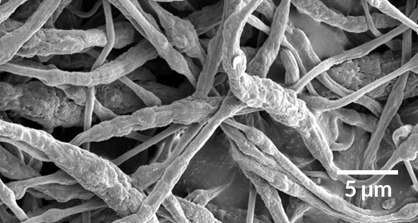 ajitjohnson_n's tweet photo. Scientists have developed a new method to keep cell phone batteries from catching fire. #SmartFibres https://t.co/NtJ18rzV6p