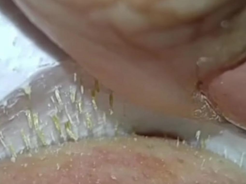 It's disgusting but oh, so, satisfying. You've never seen a pore cleansing like this before

crwd.fr/2iXRrUw