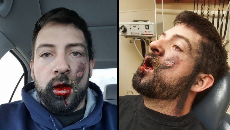 vape explosion Alberta e-cigarette explosion ignites regulation debate main image 1