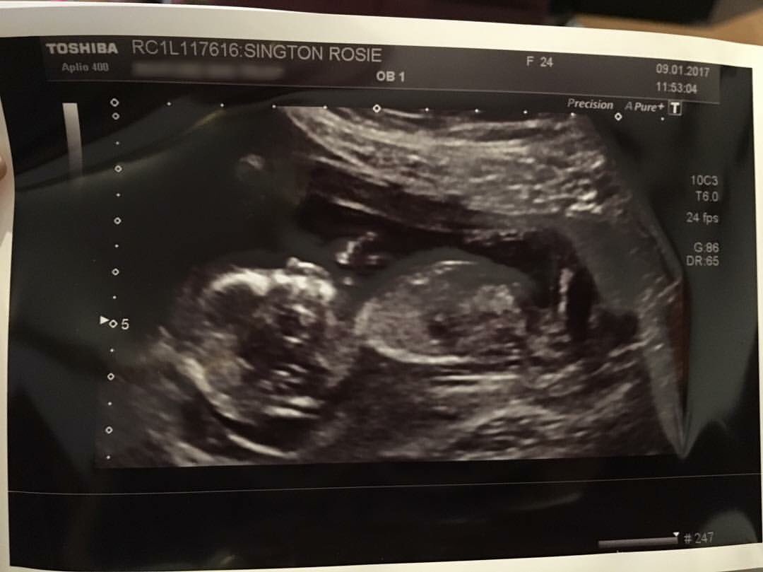 I'd like to let you know my partner &amp; I are expecting baby no.2 - due July '17. I will carry on working until then unless baby comes before!