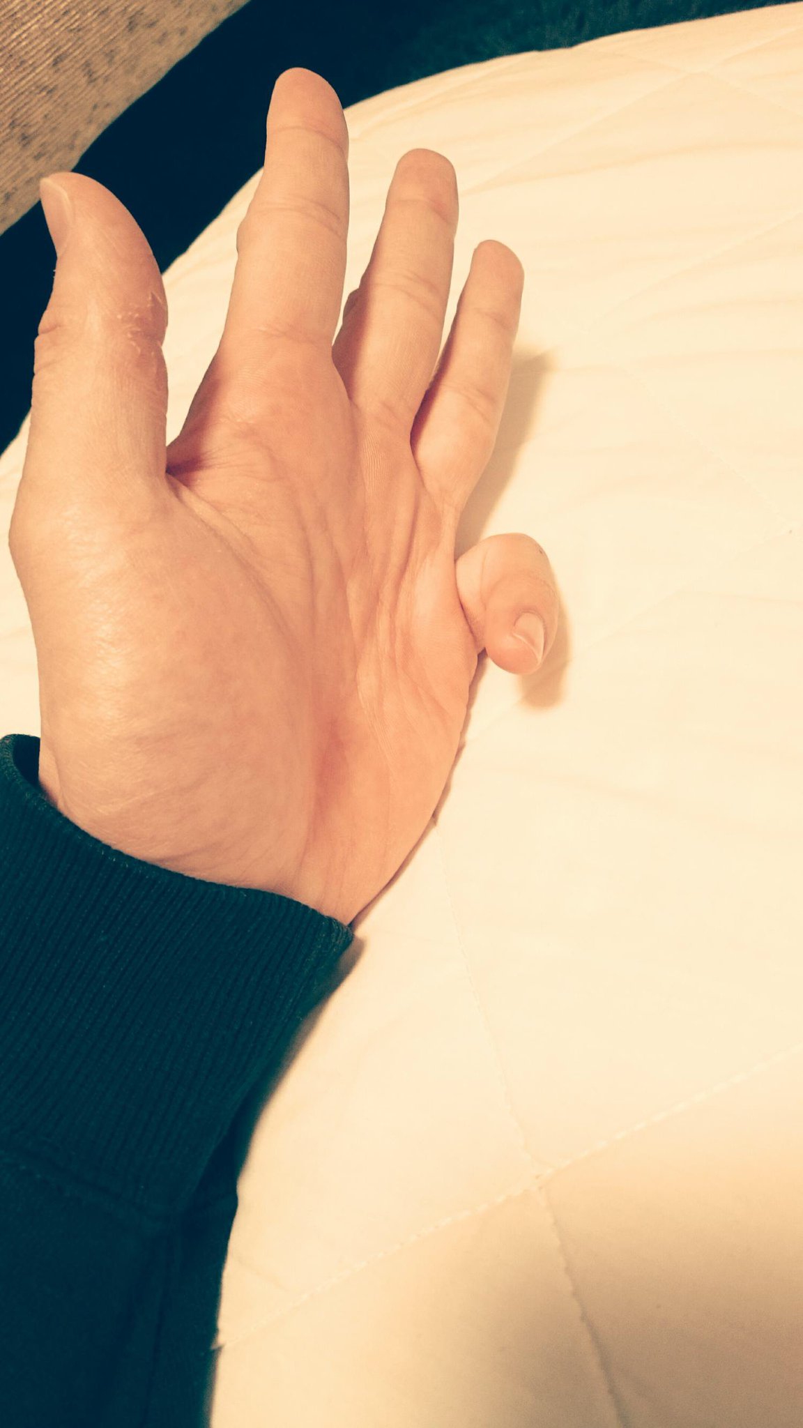 八巻貴紀 意外と他の指を動かさず 小指だけ曲げられる人が少ないことに気づいた だからなんだというのだろう T Co Uarbmtblmz Cheerzformen