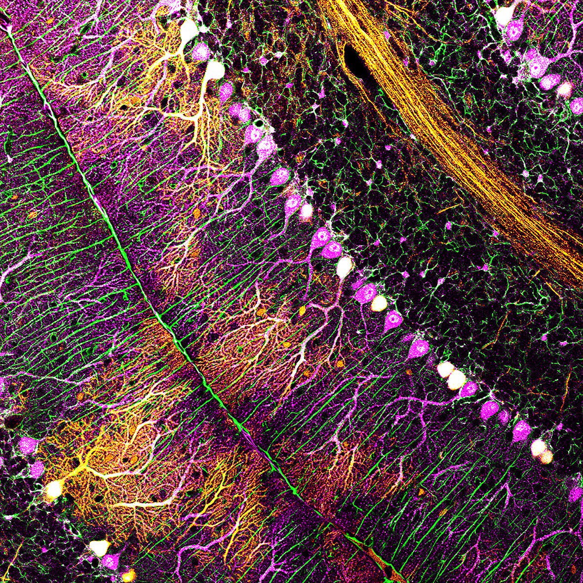 Do we agree that the cerebellum is amazingly beautiful? #Science and #Arts